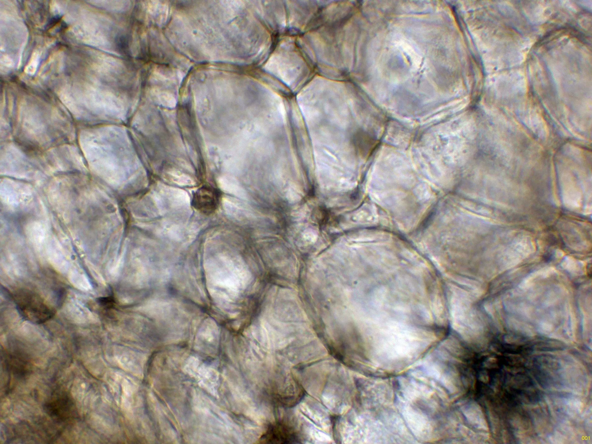 10 - Suprapellis agua x 1000-001